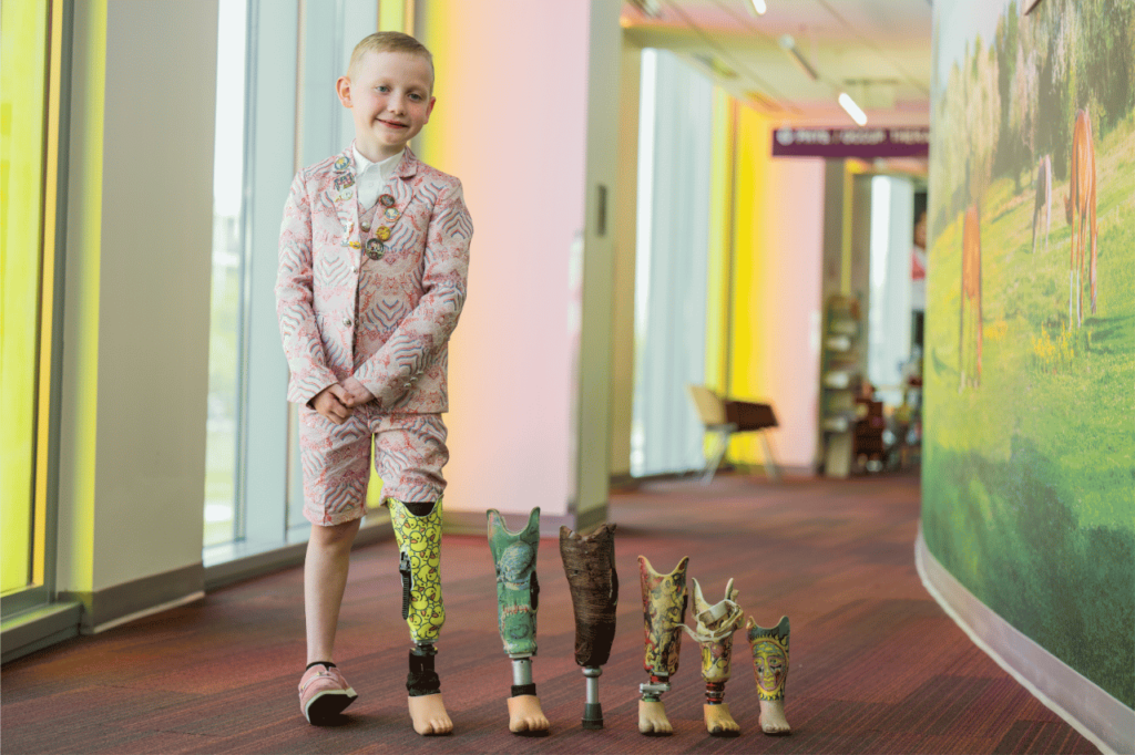 His parents weren’t sure he’d be able to run. Now, he can’t stand still. Arlo at Shriners Children's hospital with his "leggys".